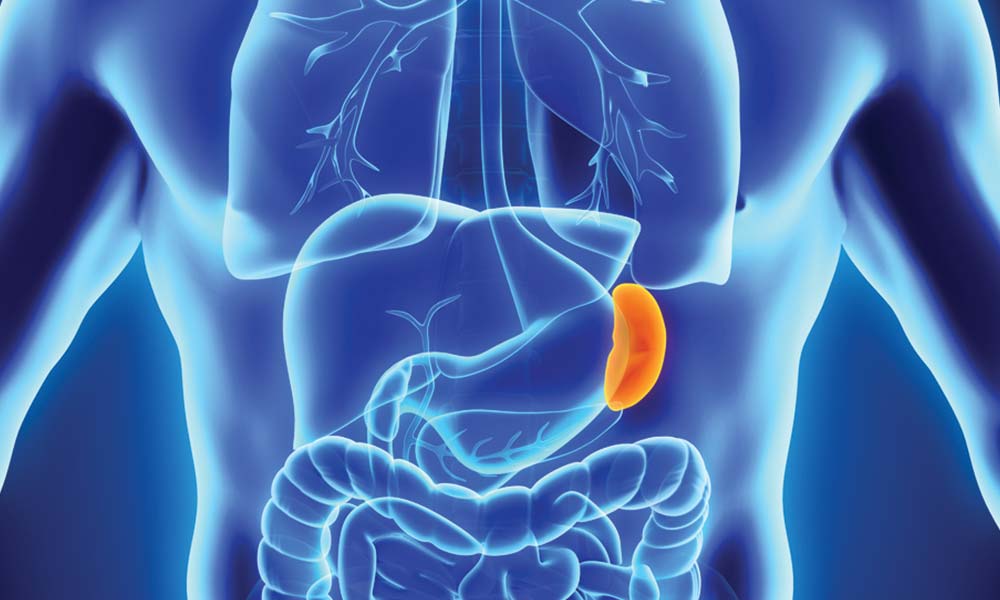 Symptoms and Causes of Enlarged Spleen (Splenomegaly)