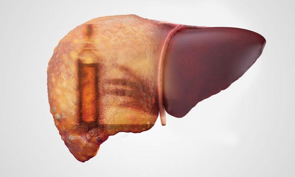 Liver Failure Causes, Symptoms, & Treatments Gastroenterology