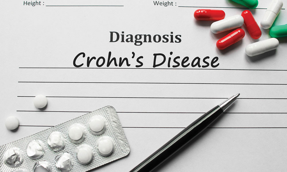 Crohns