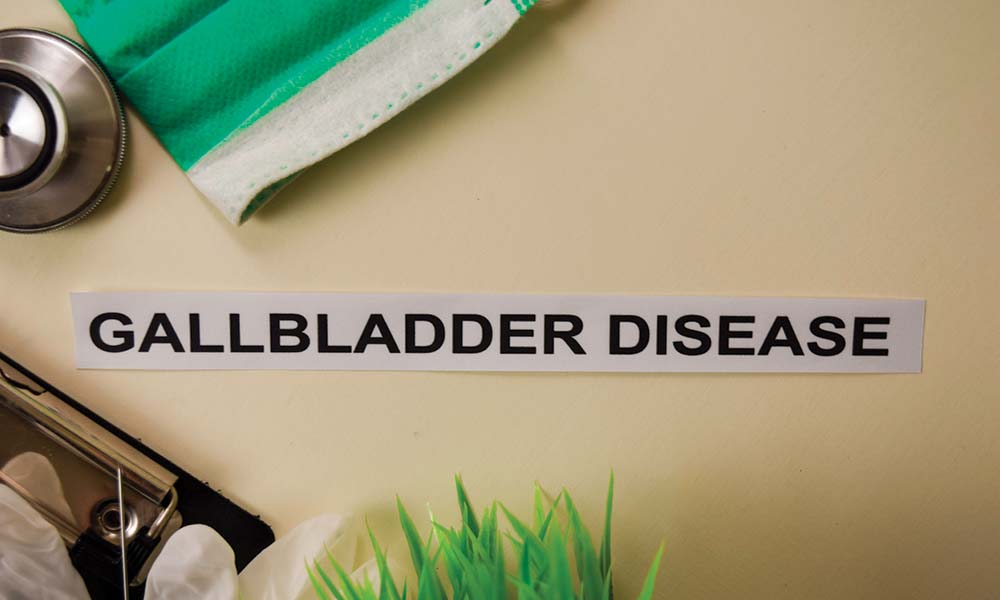 Gallstones